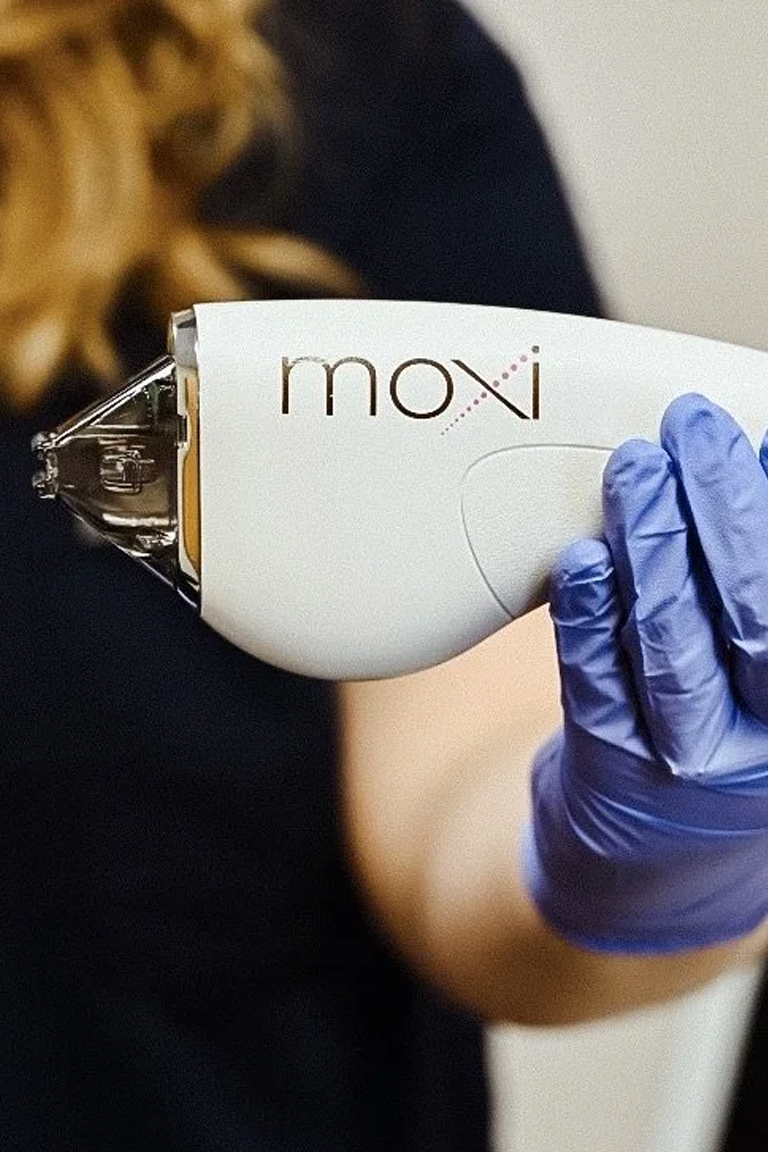 MOXI laser by Sciton used at Chic Derm & Aesthetics in Allen, TX